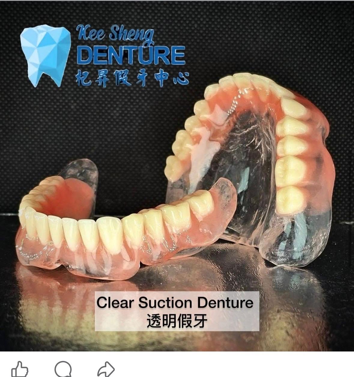 Clear Suction Denture