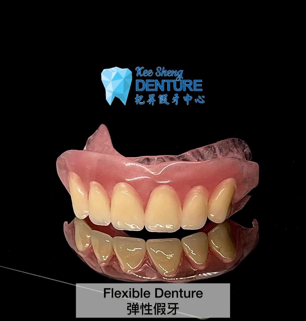 Flexible Denture