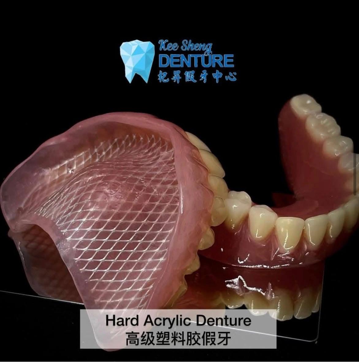 Hard Acrylic Denture